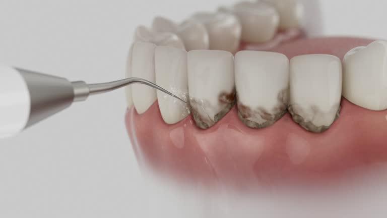 Trusted Dental Implants service in Lake of the Woods, VA - Dentist Open Now